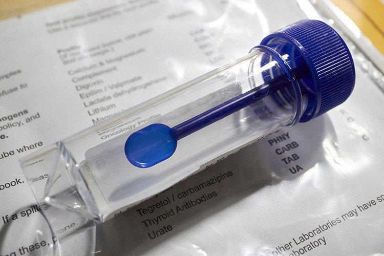 Araştırma İçin Numune Analizi